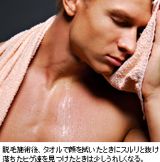脱毛施術後、タオルで顔を拭いたときにスルリと抜け落ちたヒゲ達を見つけたときは少しうれしくなる。